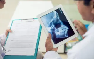 Skull x ray