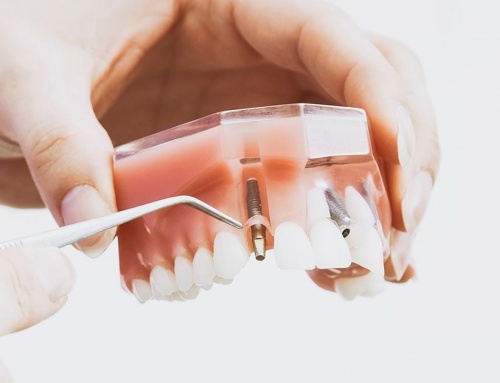 Your Orthodontic Appliances