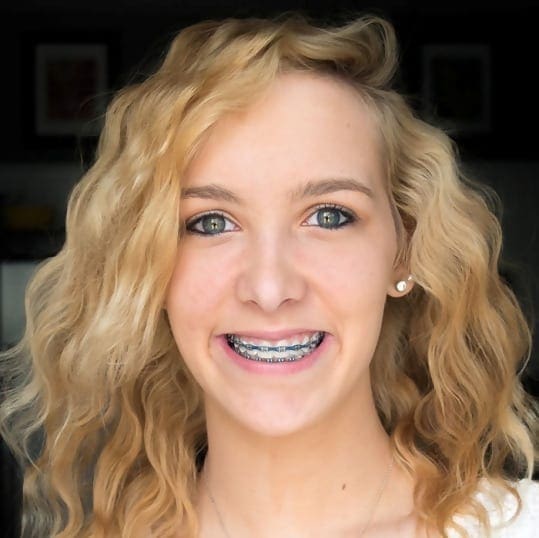 Debunking 7 Braces Myths Alexandria Orthodontics