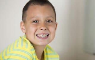 Boy showing his teeth braces.