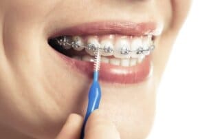 Beautiful smiling girl with retainer for teeth